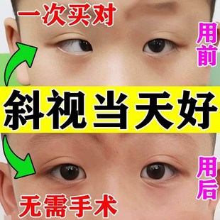 斜视矫正训练器聚散球视力纠正眼睛内外斜弱视斗鸡眼儿童眼药水贴