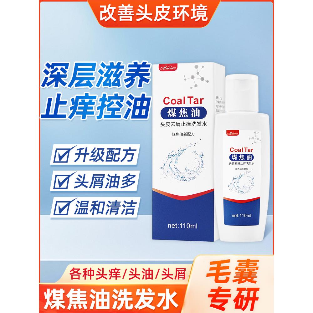 煤焦油洗发水头皮止去屑去头油清爽发脂溢性正品男士女