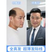 正品 精递男士 假发气无痕织发补片男短发帅真发人发丝秃发顶头顶补