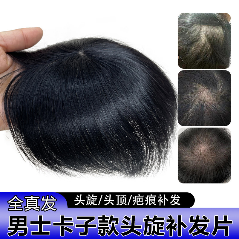 假发片男全真发头顶头旋发缝疤痕补发片递针旋遮斑秃脱发男士假发