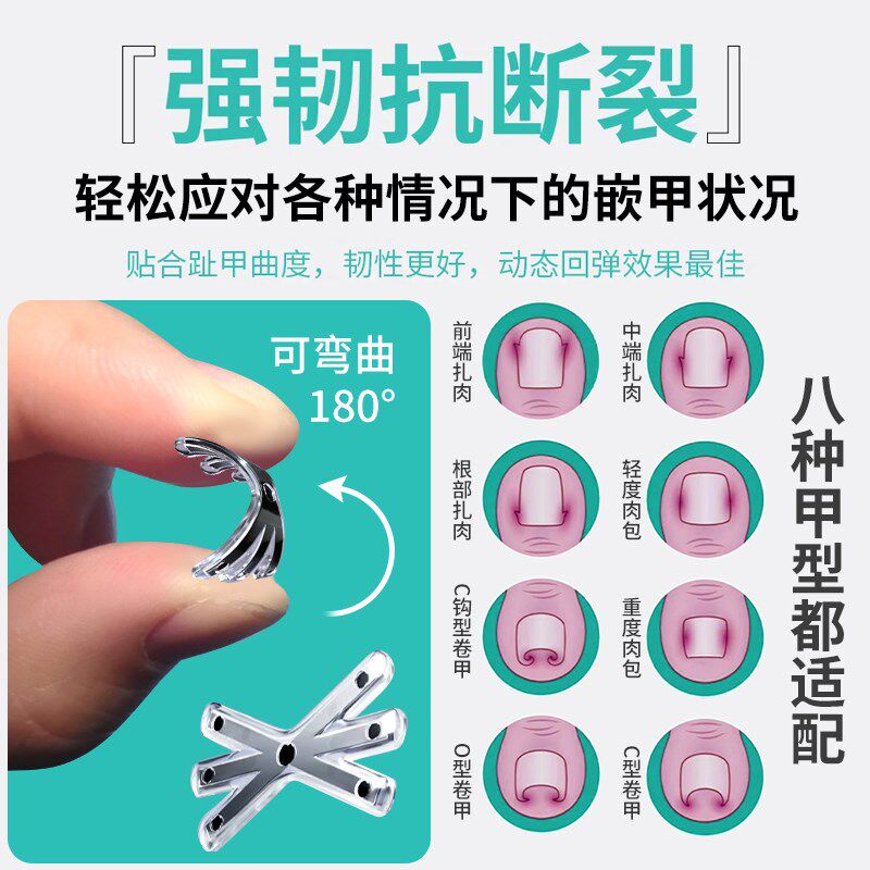 赤坂甲沟嵌甲炎矫正器正甲贴指甲内嵌纠正贴脚趾指甲往肉里长专用