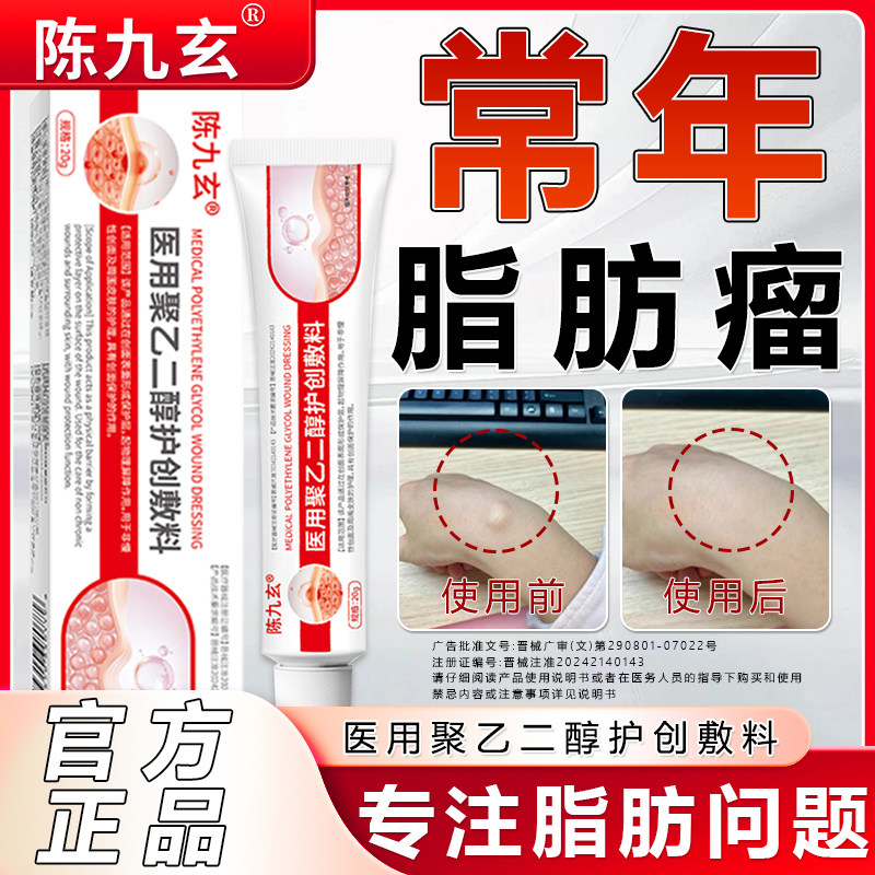 陈九玄医用聚乙二醇护创敷料专攻脂肪瘤强效配方软化硬块肌肉鼓包