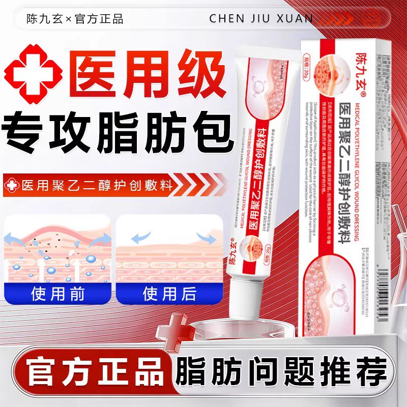 陈九玄医用聚乙二醇护创敷料专攻脂肪包囊肿硬块消瘤膏官方正品B8