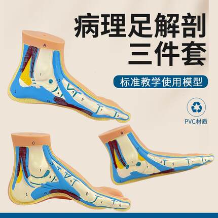 足部模型 人体脚掌肌肉模型弓形脚掌模型 脚解剖模型平板足正常足