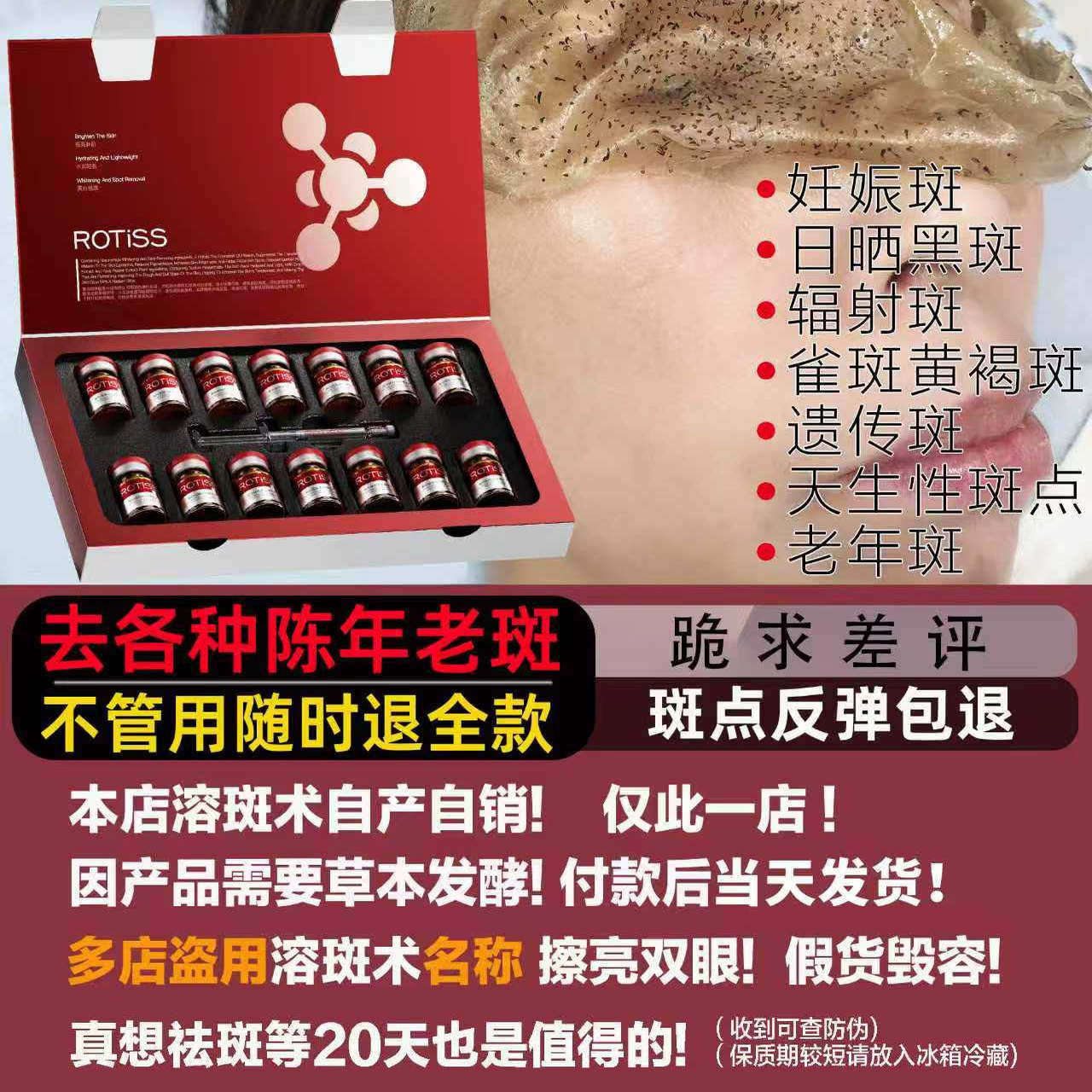 祛斑美白官方正品专治各种斑