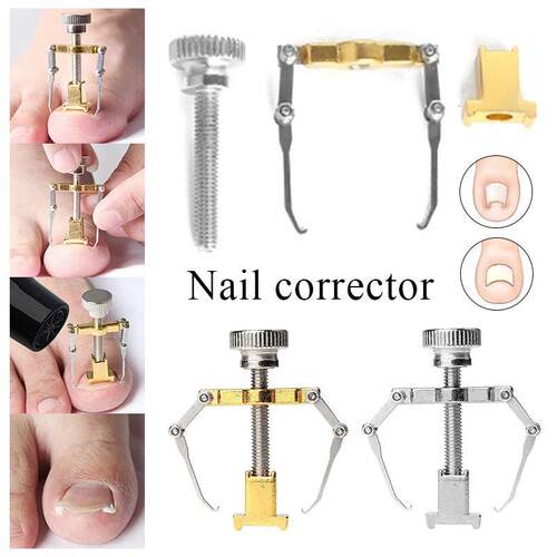Hot Ingrown Toenail Corrector Nail Straighten Clip Ingrown T