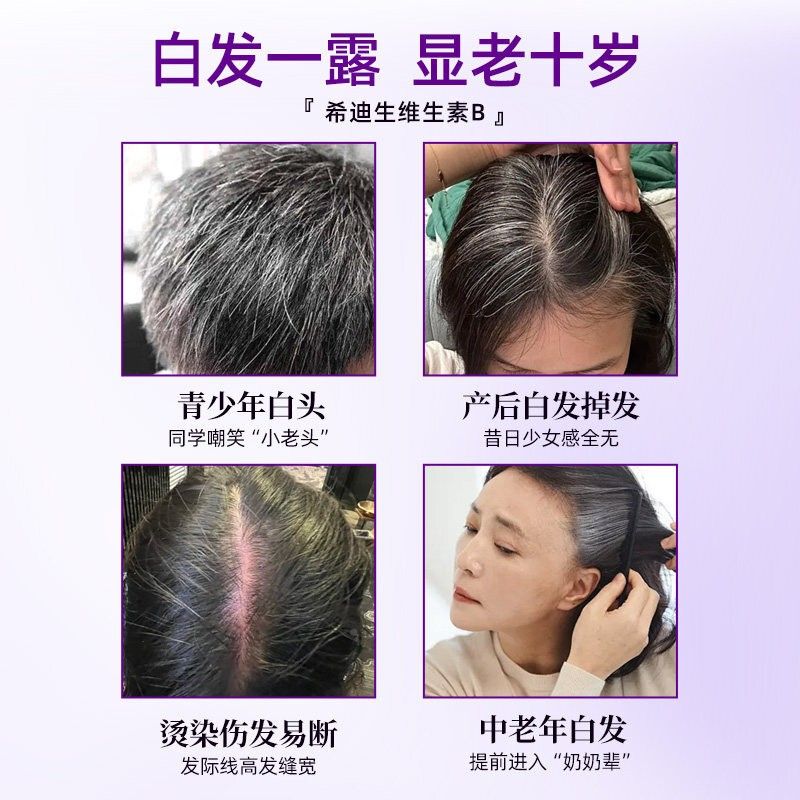 希/迪/生维生素B白发发脱发护秀维生QIE素固B发中老年黑黑发发健