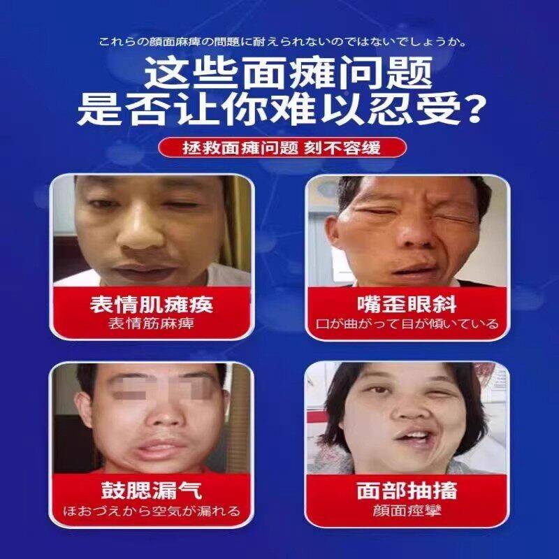 脸训练部器牵正后遗症面复神器热敷贴颜PCE恢瘫复通恢肌痉挛面瘫
