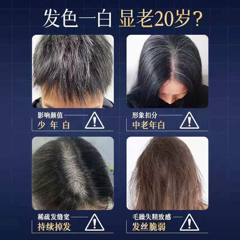 百/乌芝桑乌参生 男女白发鸟养发护ZUI黑固发秀发滋养发片根官方