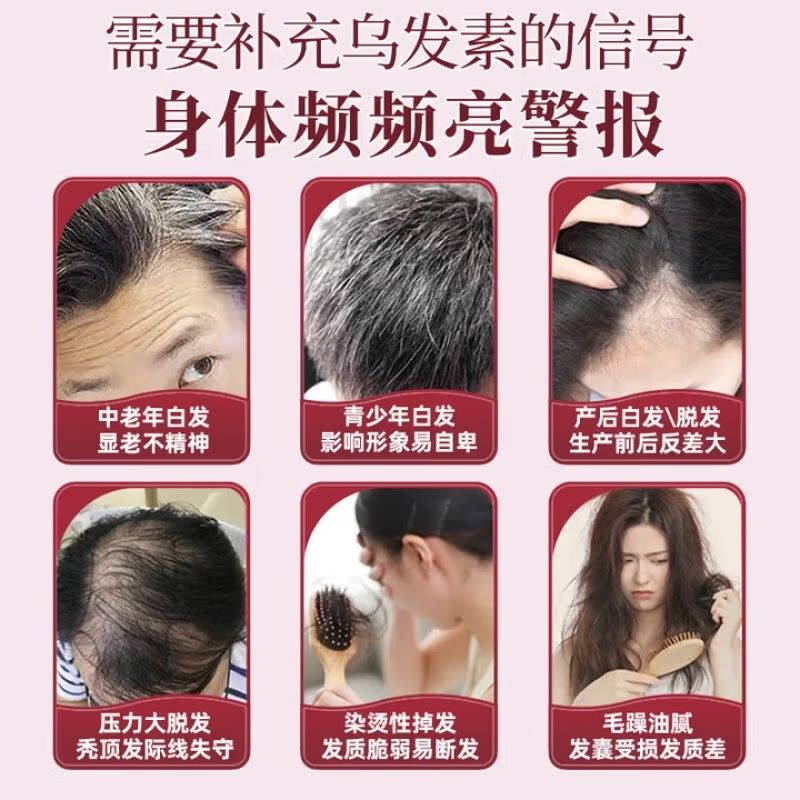 官方正品】【卡西奈维生素b黑发西耐生HSU卡素d3乌发素维旗舰店