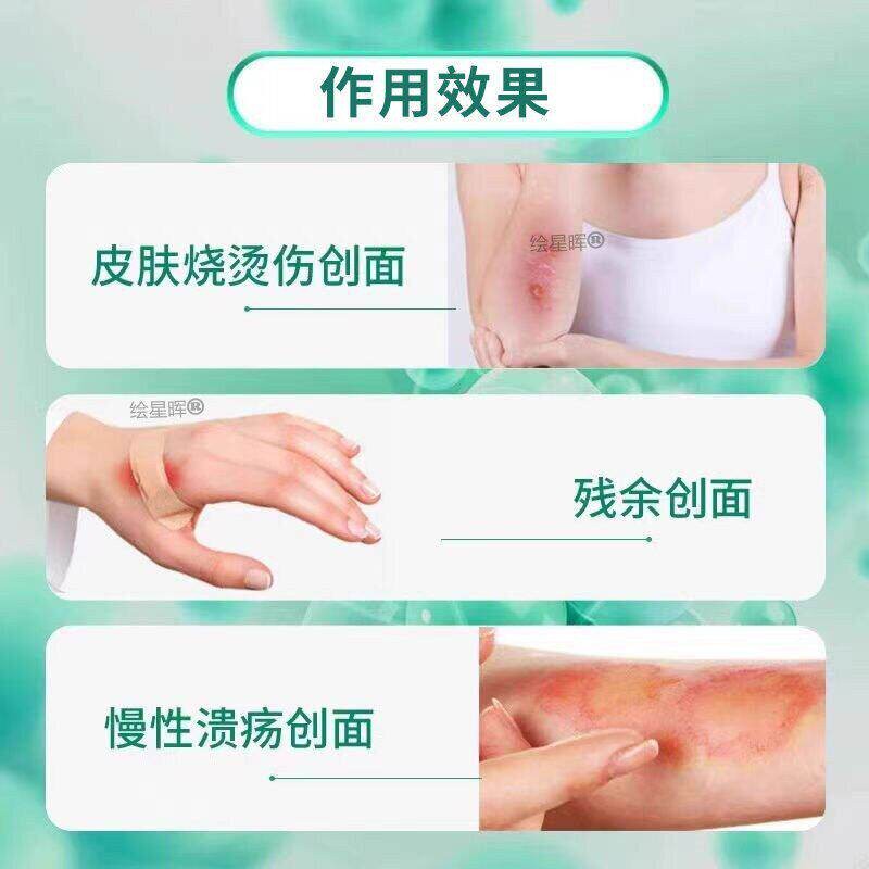 重组人生长因凝子胶牛碱性维成细UZT胞人体表皮皮生长因子肤修纤