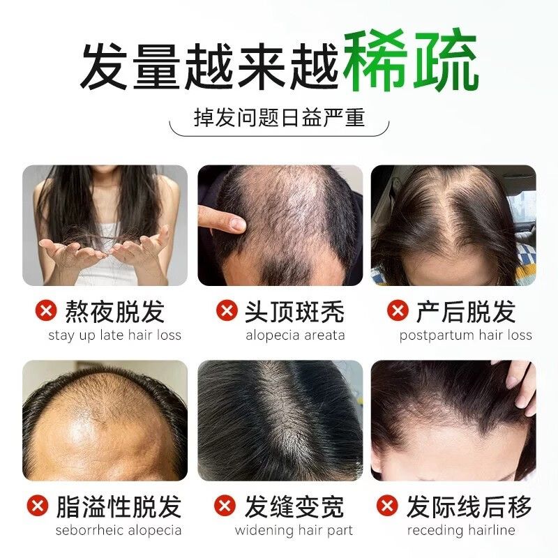 南瓜籽护维发DHIVIT阻滞赋活毛囊生素片片生物素片复合护发柔顺健