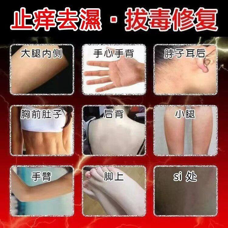 苗药皮清百草真王止痒毒ZPB快速皮肤菌痒水湿痒全身特干痒霜效抑