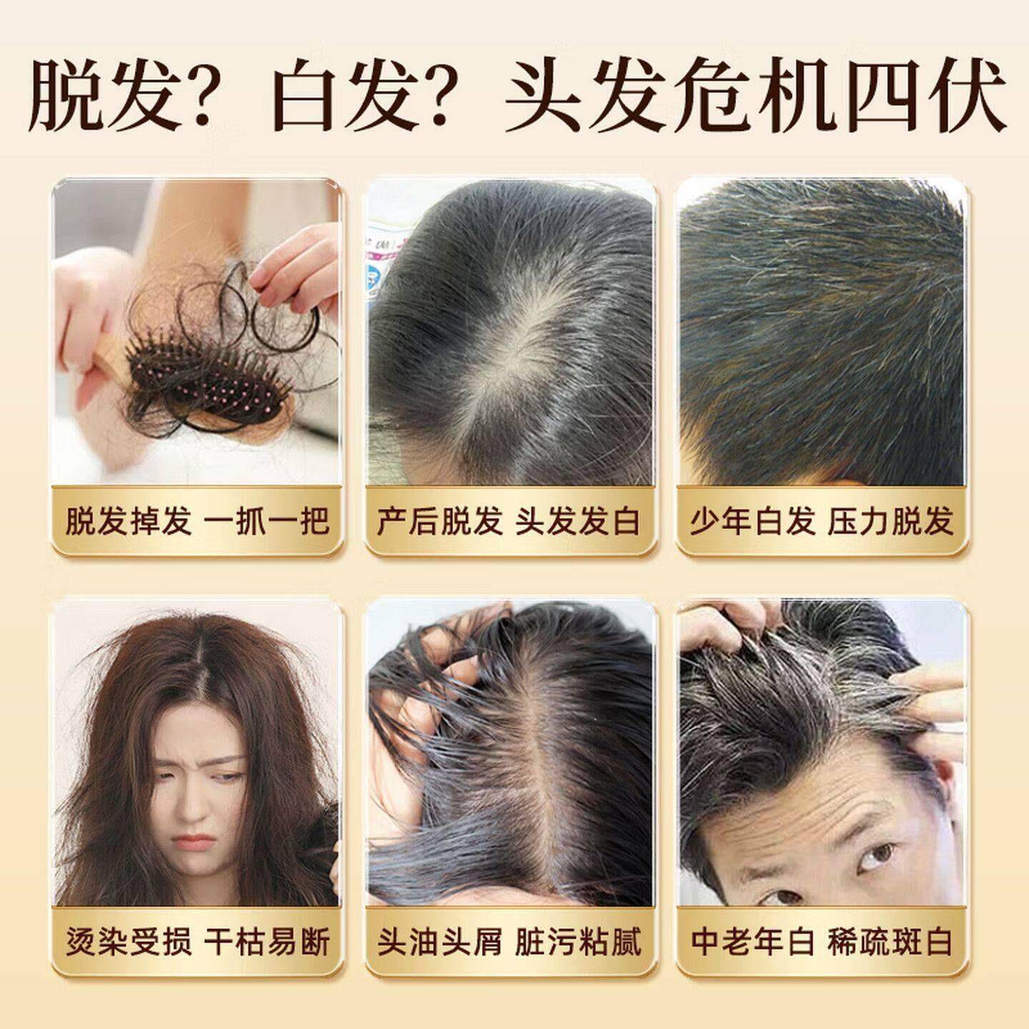 沃普希维内乌生素KRLb 沃普希维素d3发生素白发调发线后移调理黑