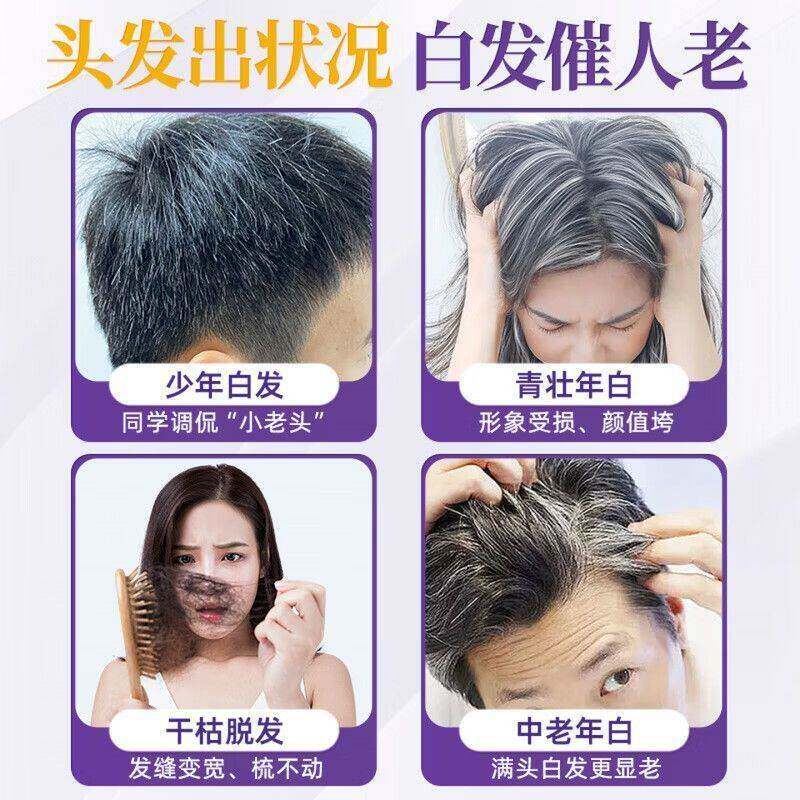 L-CAdLARIE卡爱维生素d3卡爱维生素白B维健搏迪生FMK素3调发少中