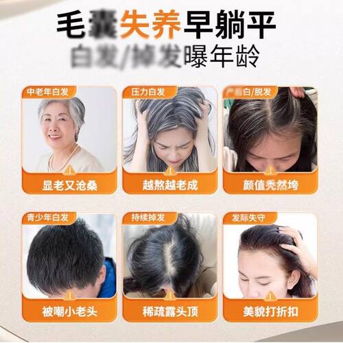 dabaq维IKQ生素达康白发黑发掉旗店发护秀多舰种维生素B族头品发