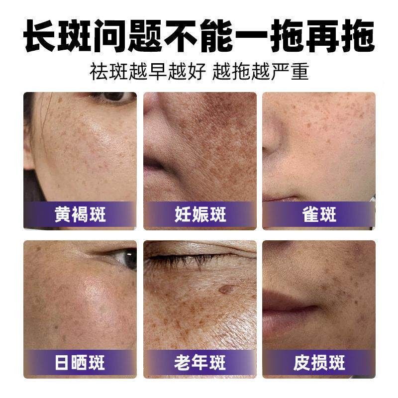 云南白药维联合邦利牌葡萄籽生素E软胶黄斑囊祛淡黄褐雀斑ZUC提亮