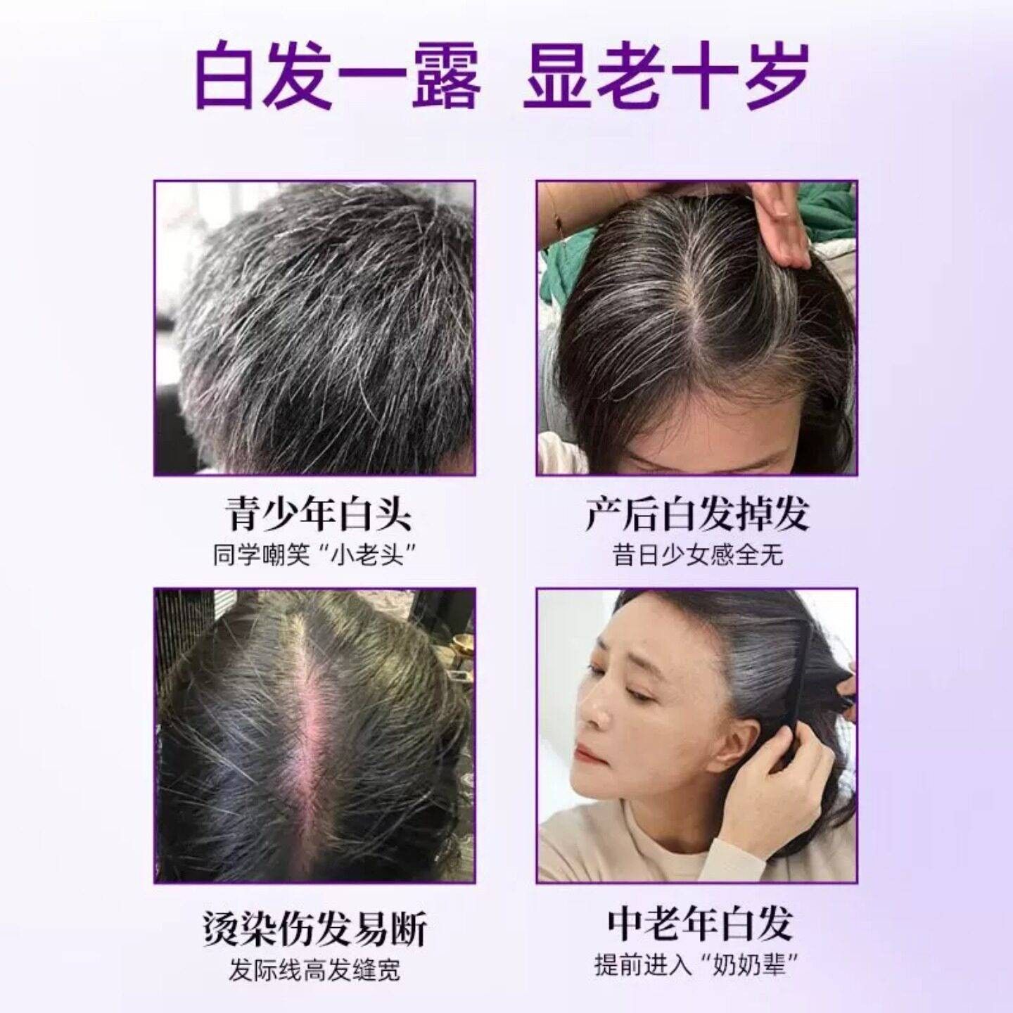 ox用希生维生ZDH素B迪乌发素生物素白发黑发脱发固中老方年适官正