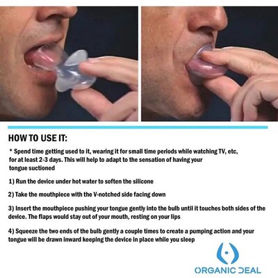 Anti Snoring Mouthpiece Tongue Retainer Helps to Eliminate S
