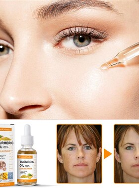 Turmeric Lemon Oil Skin Glow To Lightening Acne Dark Patches