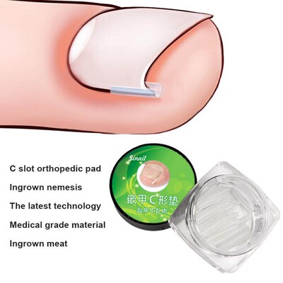 Ingrown Toenail Correction Pads Ingrown Nail Pad Silicone In