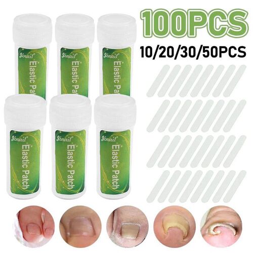 10-100PCS/Bottle Ingrown Toenail Correction Tool Ingrown Toe