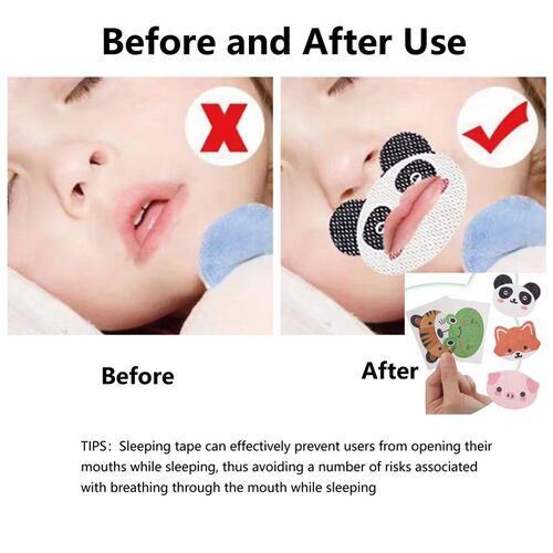 30PCS  Anti-Snoring Mouth Patch Improving Patch For Children