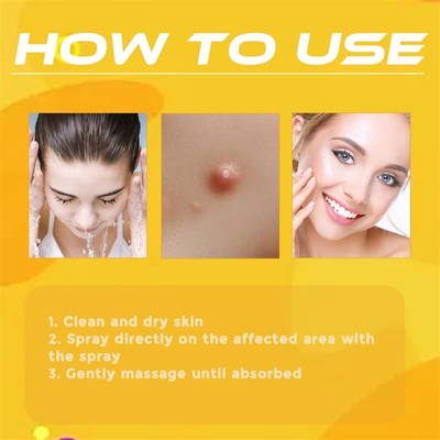 Revitalize Your Skin With Ximonth Bee Venom Spray For Wart C