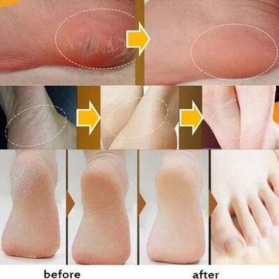 Herbal Anti Crack Foot Cream Heel Crack Repair Products Exfo