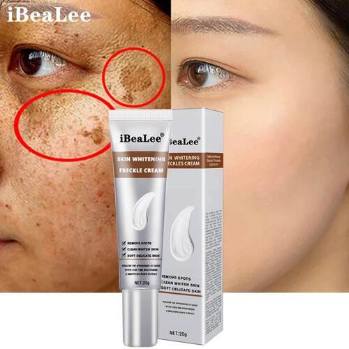 Whitening Freckle Cream Remove Melasma Cream Remove Dark Spo