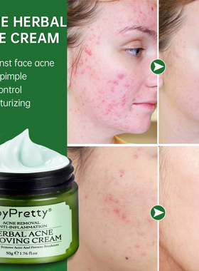 Acne Face Cream Herbal Pimple Scar Removal Shrink Pore Oil C