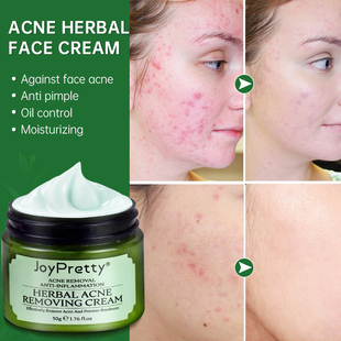 Acne Face Cream Herbal Pimple Scar Removal Shrink Pore Oil C