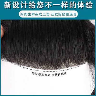 Spot Wig Mens Hair Replenishing Tablets For Real Person Hai