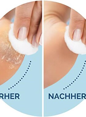 Foot Care Tool Electric Foot File Foot Callouses Dead Skin R