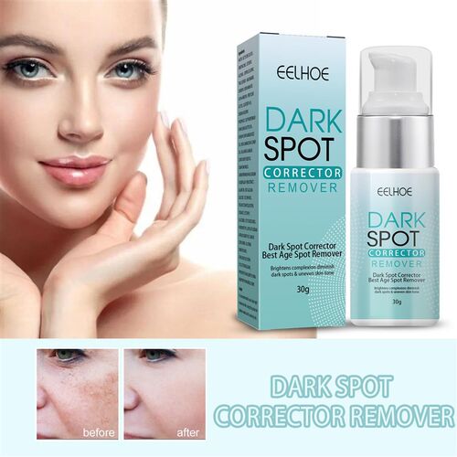 30g Dark Spot Remover Corrector Age Spot Freckle Removal Emu