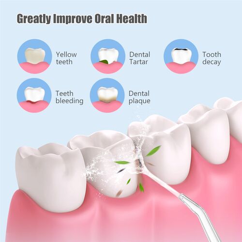 Oral Irrigator Dental Water Flosser Portable Dental Water