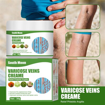 Varicose Veins Relief Cream Vasculitis Phlebitis Spider Leg