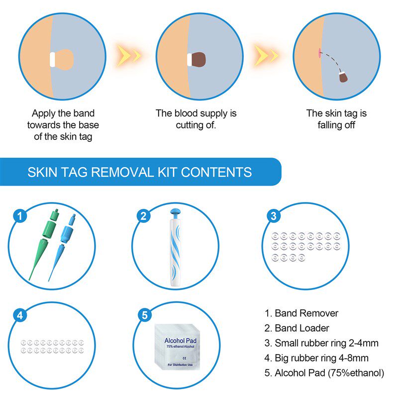 Skin Tag Remover Mole Remover Skin Tag Removal Kit Auto Tag - 实物图