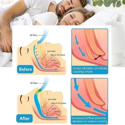 Anti-Snoring Corrector Snore Prevention Gadget Womens Anti-