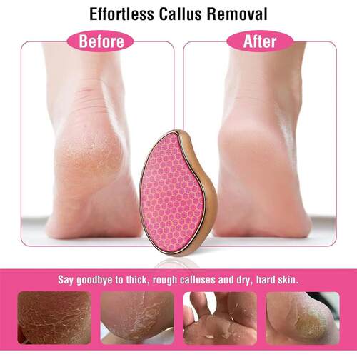 High Quality Nano Glass Heel Scraper  Feet Shower Foot  Scru
