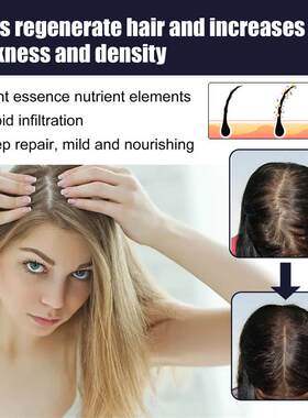 Ginger Hair Growth Essential Oil Fast Grow Anti Hair Loss Pr