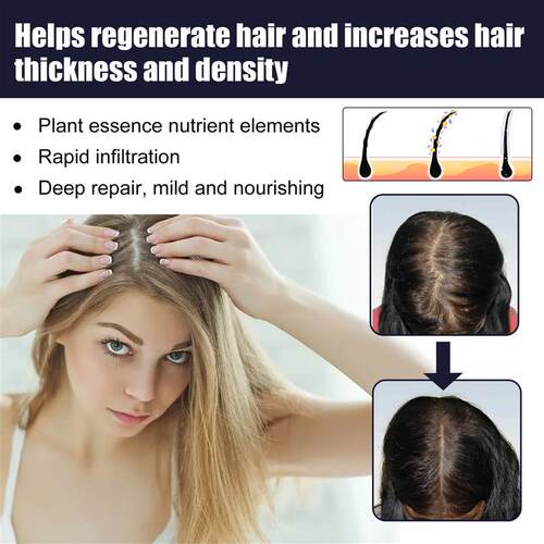 Ginger Hair Growth Essential Oil Fast Grow Anti Hair Loss Pr
