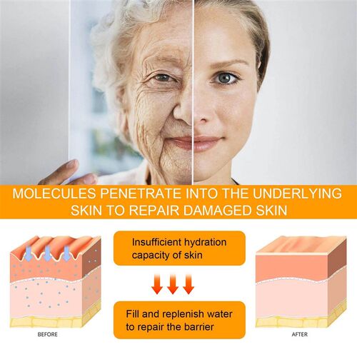HOYGI 5D Peptide Eye Repair Cream - Fades fine lines and cro
