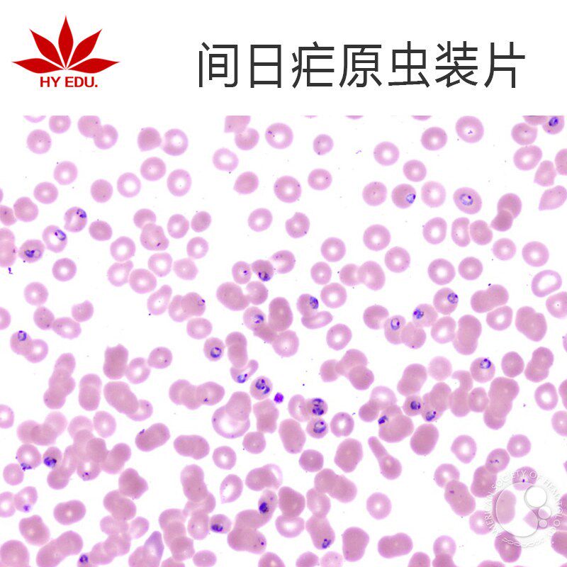寄生虫类间日疟原虫装片显微镜生物玻片高教教学成像清晰