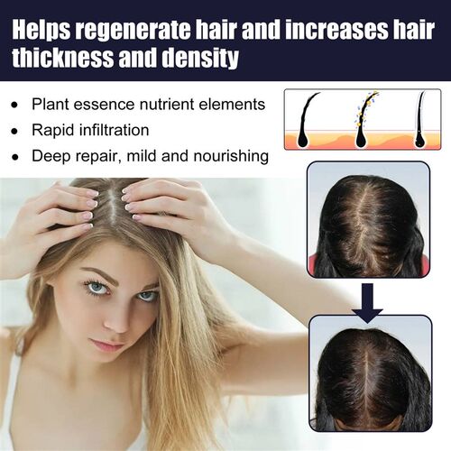 Ginger Hair Growth Essential Oil Fast Grow Anti Hair Loss Pr