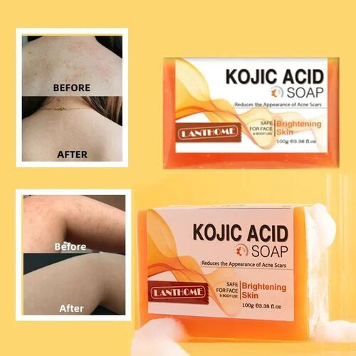 Kojic Acid Whitening Soap Kit 100g Handmake Black Drak Spot