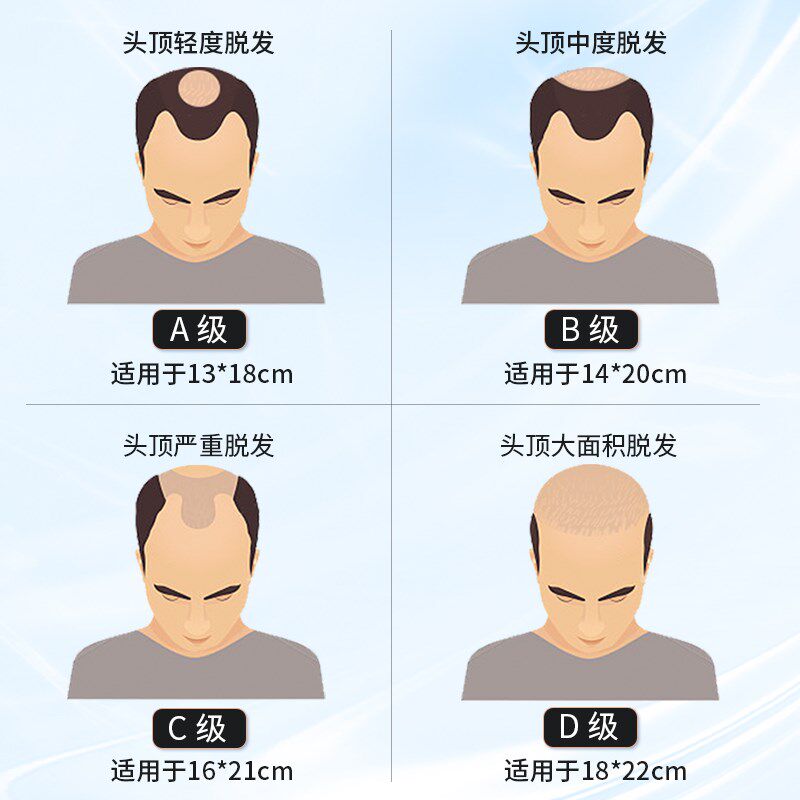 假发男士头顶补发递针全真发织发块秃顶肤化发际线隐形无痕短毛寸