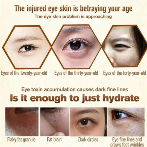 Fat Granules Remover Eye Cream Effective Remove Fat Granules