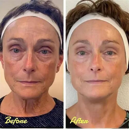 30ML C?lyn Make Up Eye Firmer Eye Lift Firm Eye Bag Removal