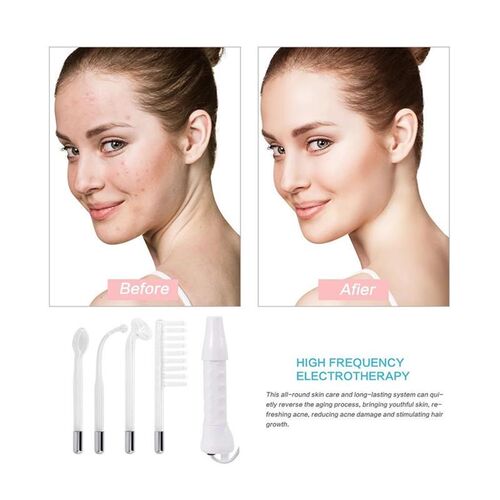 4 In 1 High Frequency Facial Wand Portable Electrotherapy Gl